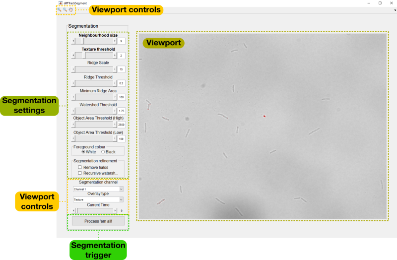 segmentationannotatednew.png segmentationannotatednew.png